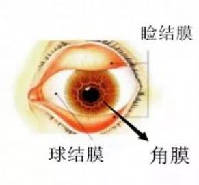 結(jié)膜炎,過(guò)敏性結(jié)膜炎,惠州希瑪眼科醫(yī)院