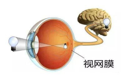 視網膜脫落,視網膜撕裂,近視手術,惠州希瑪林順潮眼科醫院